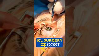 What Is ICL Surgery Cost [upl. by Eniluqcaj]