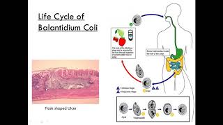 Balantidium Coli Class Ciliate Parasitology [upl. by Veda988]