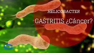 Helicobacter principal causa de gastritis y posiblemente de cáncer [upl. by Hisbe596]