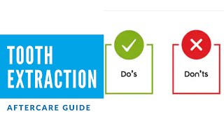 Tooth Extraction Aftercare  Dental Post Extraction Instructions [upl. by Enaerb]