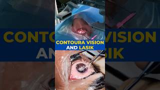 Contoura Vision And Lasik Surgery [upl. by Inatirb694]