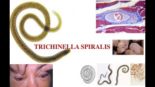 Triquinella spiralis [upl. by Leoy]