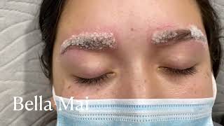 Eyebrow Salt and Saline Removal [upl. by Forta]