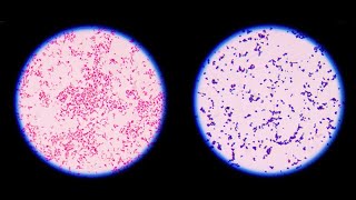 Staining technique in microbiology Gram staining [upl. by Mackie818]