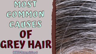 MOST COMMON CAUSES OF GREY HAIR [upl. by Gamber]