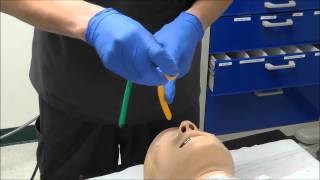 Nasal Intubation [upl. by Sension]