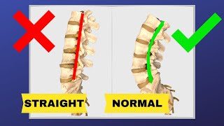 How To Correct Straightening Of Lumbar Spine FIX LOSS OF LUMBAR LORDOSIS  Dr Walter Salubro [upl. by Pape616]