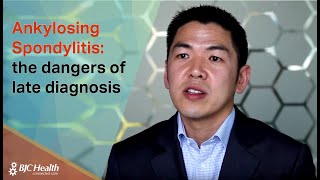 Ankylosing Spondylitis the dangers of late diagnosis [upl. by Ramedlav]