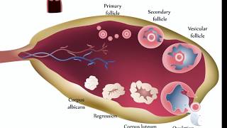 Ovarian Cysts [upl. by Siubhan]