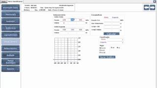 Tutorial AudioControl V3  Imitanciometria [upl. by Wheaton]