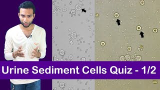 Urine Sediment Cell Identification Training Quiz  12 [upl. by Sidonia470]