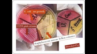 Mannitol salt agar  Staphylococcus aureus  MSA [upl. by Domella]